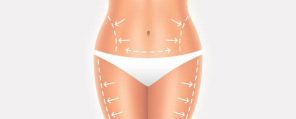 vaser liposuction nedir